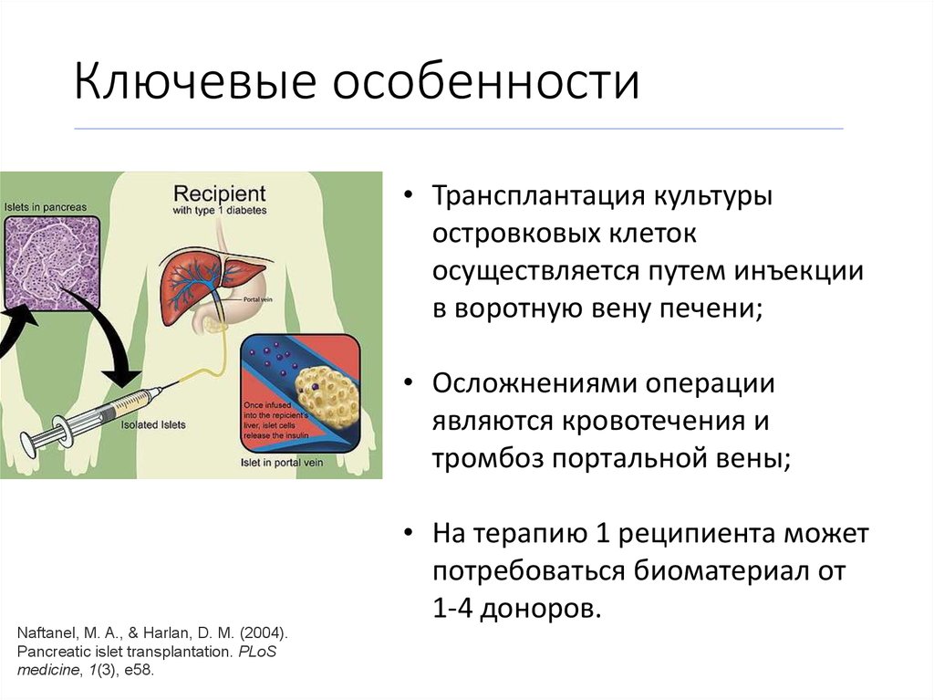 Тесты трансплантация поджелудочной железы