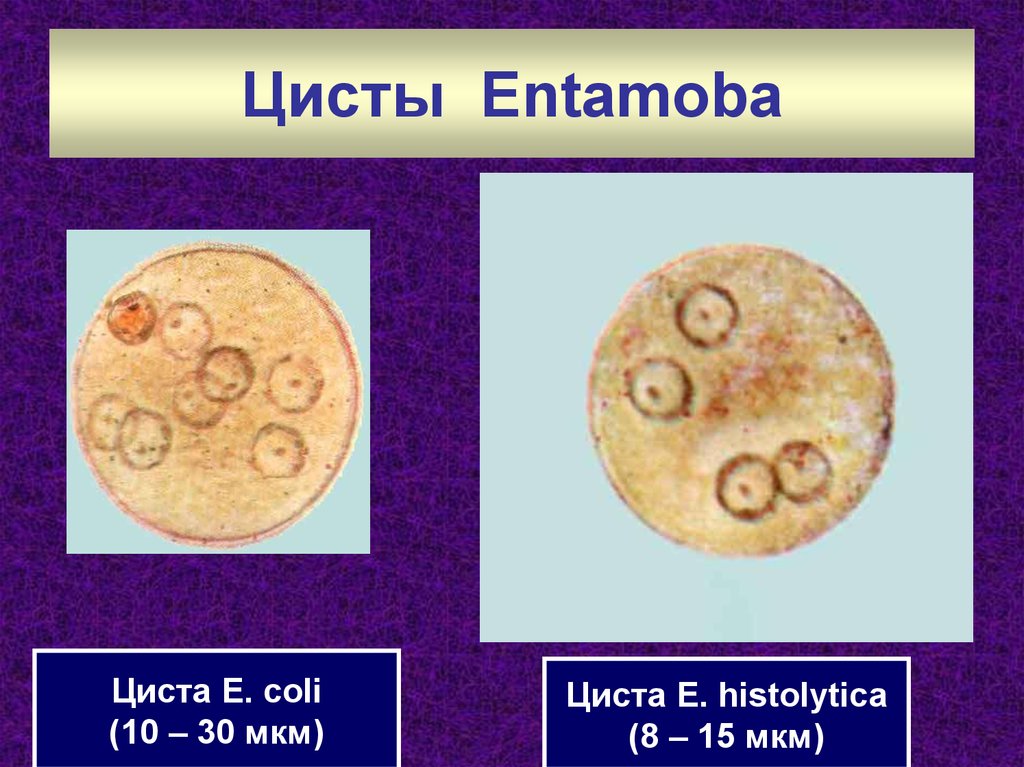 Циста это. Цисты. Циста одноклеточных. Цисты простейших образуются. Оболочка цисты.