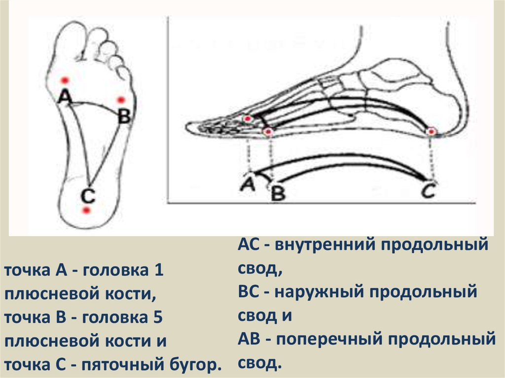 Расстояние между костями. Головка 1 плюсневой кости. Внутренний продольный свод стопы. Поперечный свод стопы. Наружный продольный свод стопы.