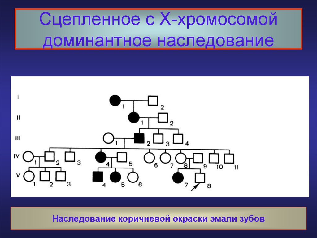 Сцепленное с х хромосомой. Сцепленное с х хромосомой доминантное наследование. Родословная с х сцепленным доминантным наследованием. Х-сцепленное доминантное наследование. Сцепленный с х хромосомой доминантный Тип наследования.