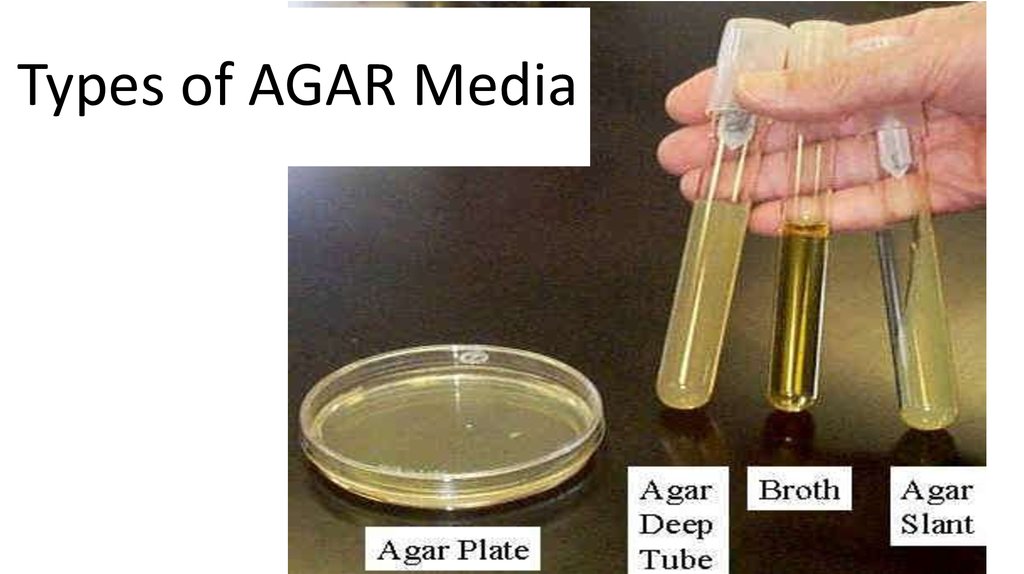 nutrition types of microorganisms