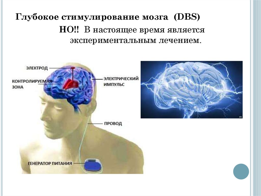 Как стимулировать мозг. Стимуляция мозга. Глубокая стимуляция мозга DBS. Мозг Бехтерева. Поощрение мозга.