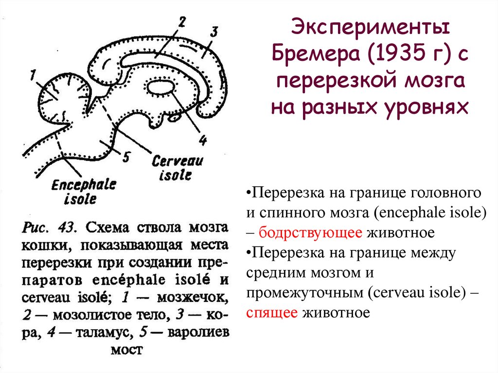 Ковид мозговой туман. Перерезка на уровне среднего мозга. Перерезка спинного головного мозга. Перерезание ствола мозга. Метод перерезки головного мозга-.