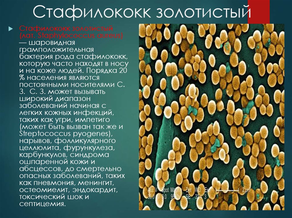 Staphylococcus aureus золотистый стафилококк. Стафилококке. Золотисоыйстафилококк. Бактерия золотистый стафилококк. Staphylococcus aureus: золотистый.