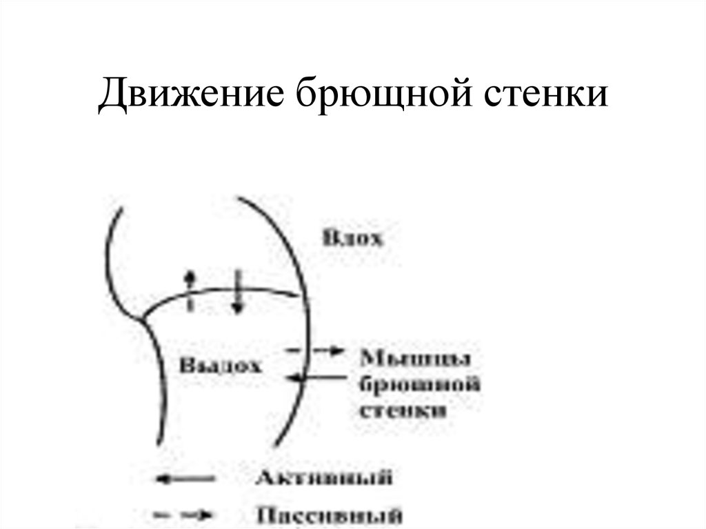 Движение доменной стенки