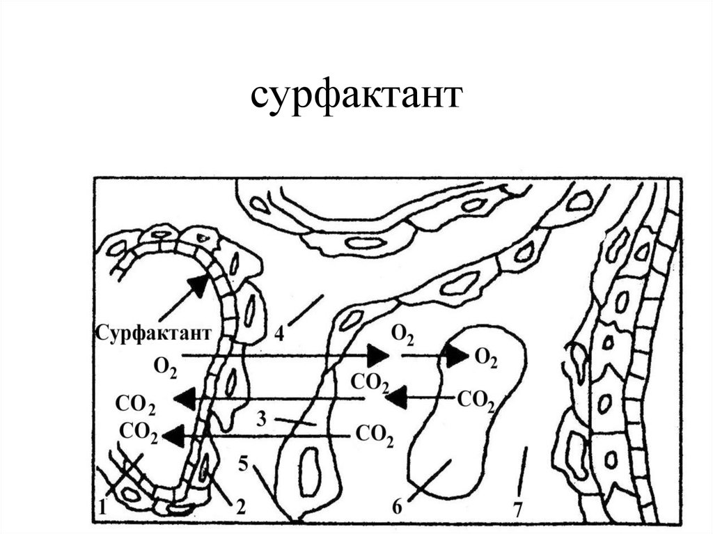 Слипанию стенок альвеол препятствует