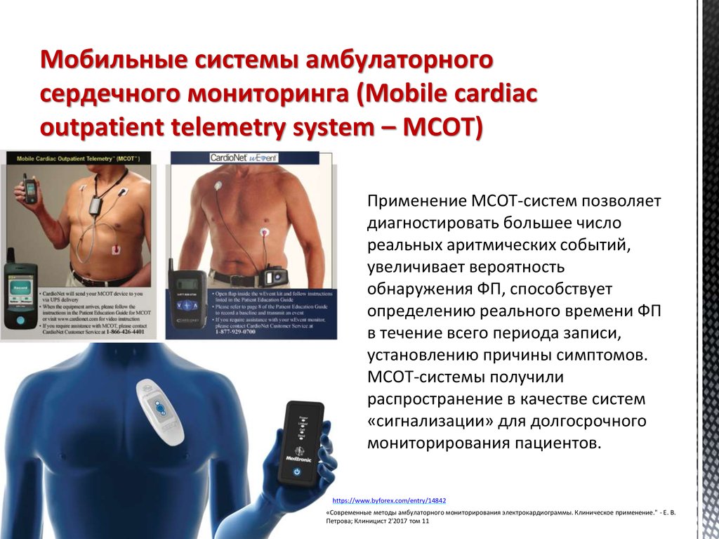 Методы мониторирования. Система мониторинга сердца. Мониторинг сердечного выброса. Амбулаторное мониторирование ЭКГ. Аппарат для мониторинга сердца.