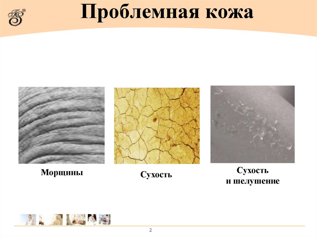 Проблемная кожа