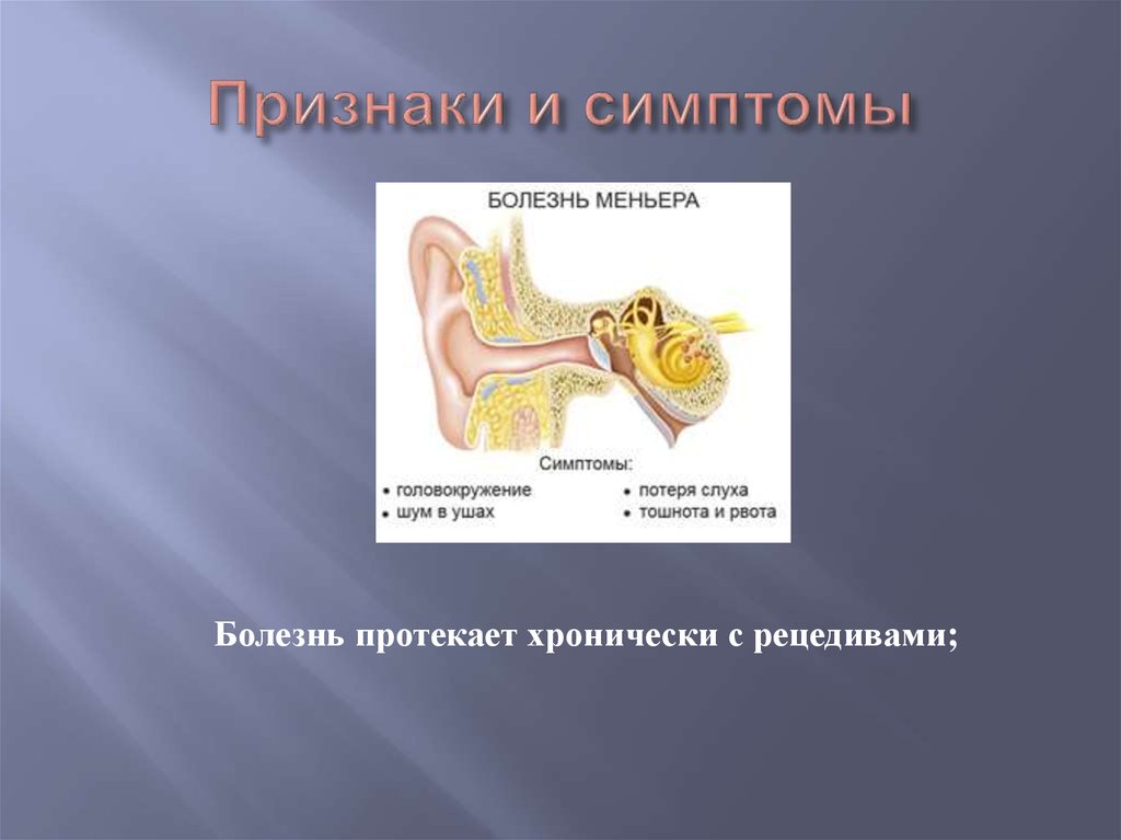 Синдром меньера это что за заболевание симптомы. Болезни внутреннего уха Меньера. Болезнь Меньера гидропс. Признаки болезни Меньера. Болезнь Меньера тугоухость.