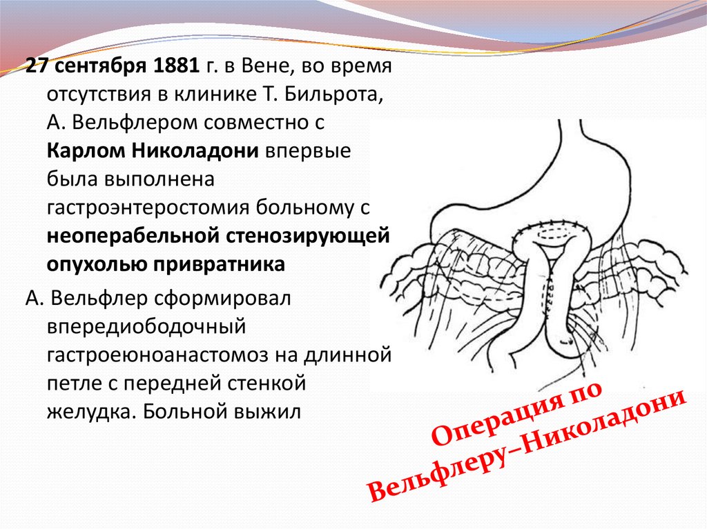 Опухоли общая хирургия презентация