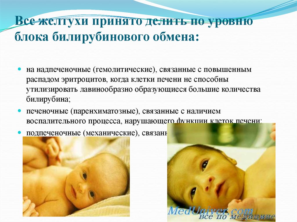 Ребенок желтуха почему. Физиологическая желтушка у новорожденных. Физиолог желтуха новорожденных. Транзиторная (физиологическая) желтуха. Физиологическая гемолитическая желтуха новорожденных.
