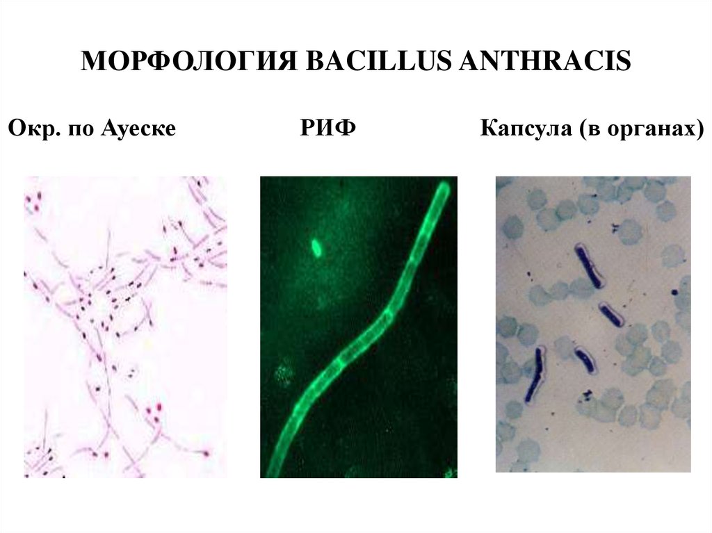 Бактерия вызывающая язву. Bacillus anthracis микробиология. Возбудитель сибирской язвы микроскопия. Бацилла сибирской язвы Bacillus anthracis.