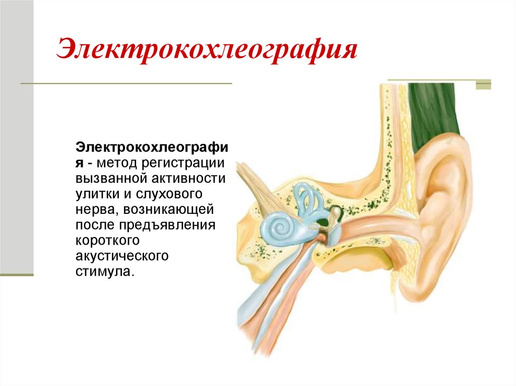 Неврит слухового нерва презентация