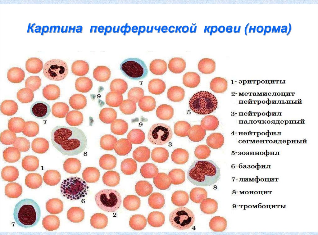 Изменение клеток крови. Клетки периферической крови нейтрофил. Картина крови эритроцитов в норме. Картина периферической крови при в12 дефицитной. Клетки периферической крови рисунок.