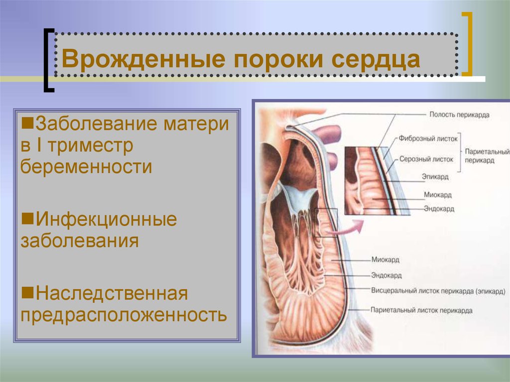 Симптомы порока сердца. Наследственные пороки сердца. Врожденные дефекты перикарда. Врожденные пороки органов чувств.