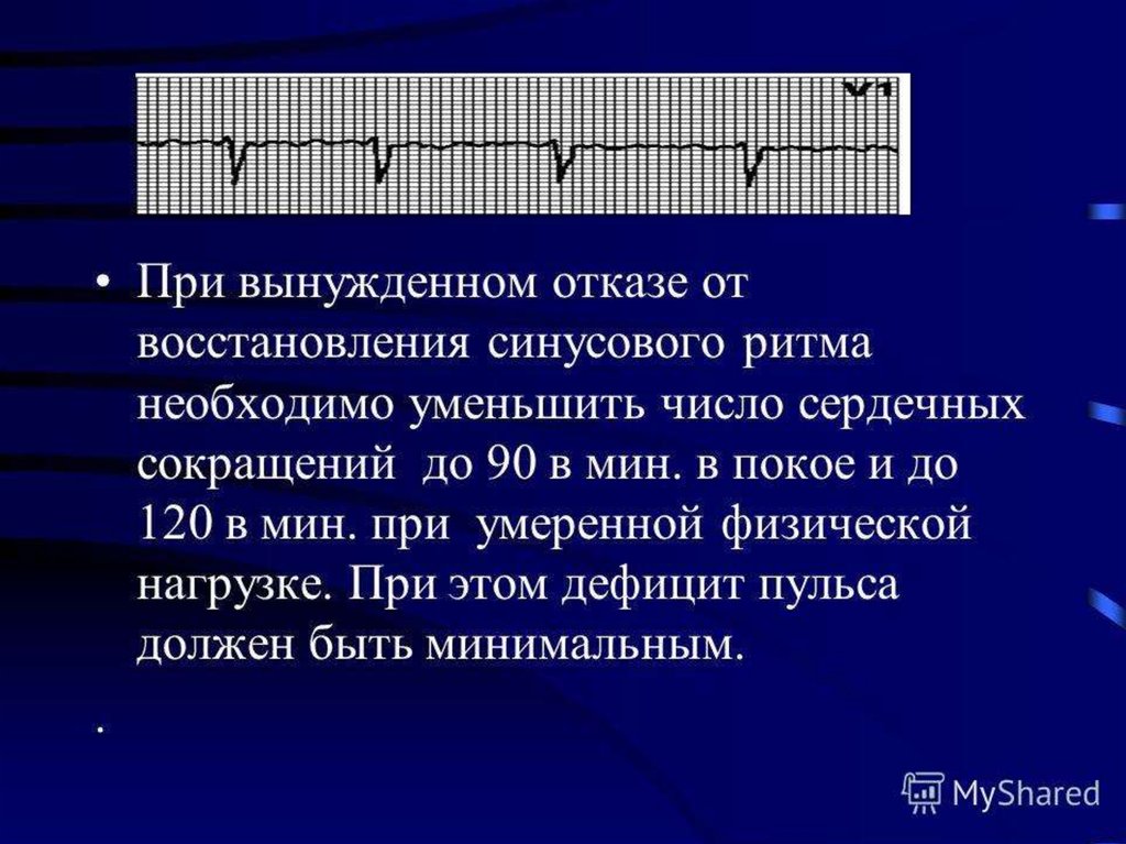 Сбился ритм. Восстановление ритма при фибрилляции. Трепетание предсердий классификация. Восстановление сердечного ритма при фибрилляции. Восстановление синусового ритма сердца.