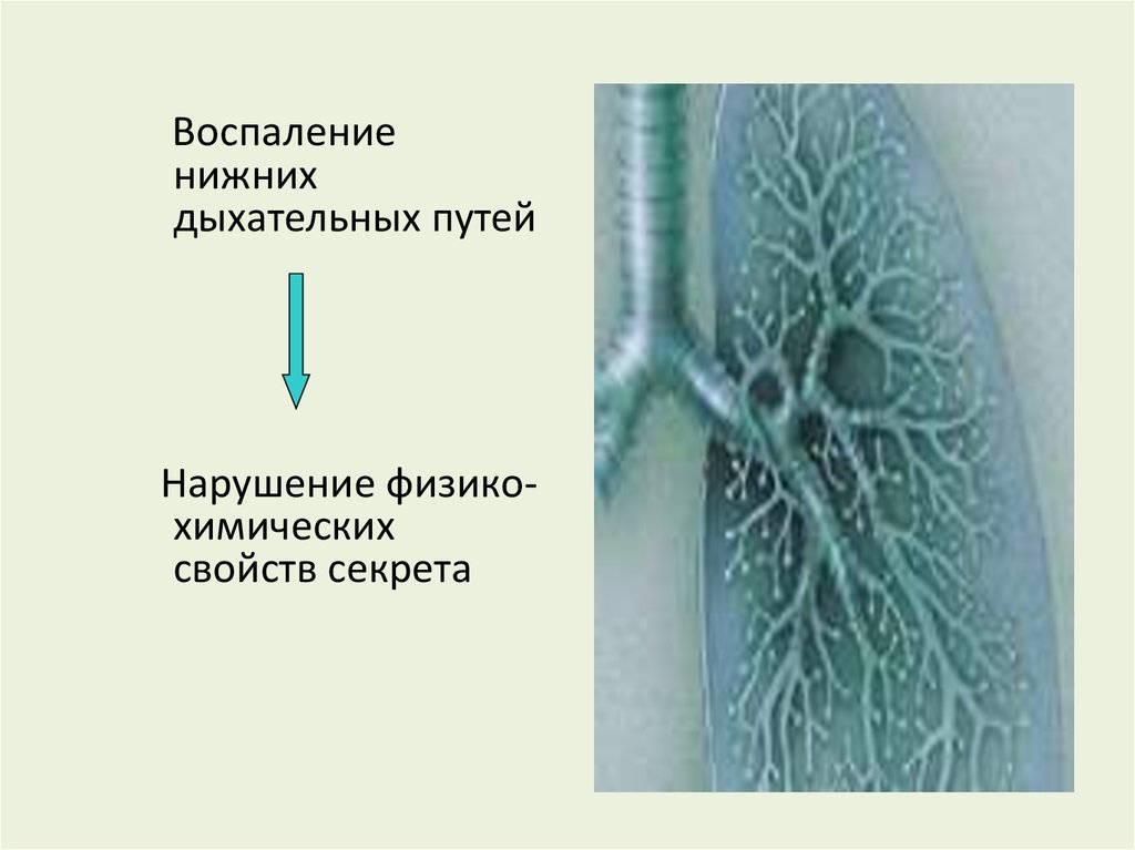 Воспаление дыхательных. Воспаление дыхательных путей. Воспаление нижних дыхательных путей лечение. Кашель в нижних дыхательных путях. Боль в нижних дыхательных путях.