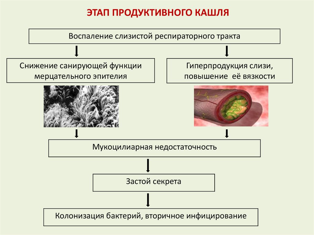 Продуктивный кашель. Кашель (продуктивный и непродуктивный). Классификация. Причины мало продуктивного кашля. Виды продуктивного кашля.