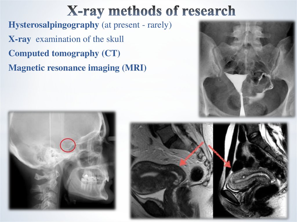 Methods Of Examination In Gynecology 