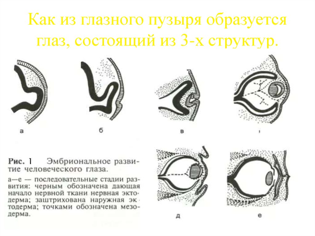 Развитие глаза. Эмбриогенез глаза гистология. Этапы развития глаза в онтогенезе. Формирование глаз у эмбриона. Орган зрения источники эмбрионального развития.