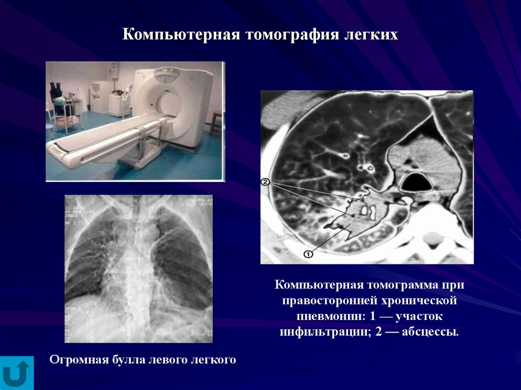 Кт 4 легкие. Компьютерная томография легких. Кт лёгких. Компьютерная томограмма легких. Кт органов дыхания.