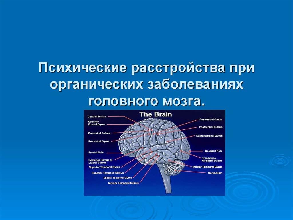 Признаки дезорганизации головного мозга. Для органического поражения головного мозга характерно. Заболевание головного мозга виды. Органические нарушения головного мозга. Мозг психических расстройств.