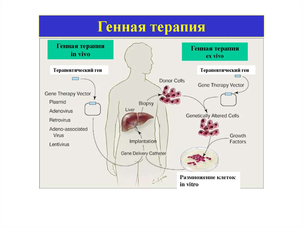 Генная терапия. Генная терапия ex vivo и in vivo. Генная терапия: in vivo, ex vivo, in situ. Генетическая терапия ex vivo. Схемы генной терапии in vivo и ex vivo.