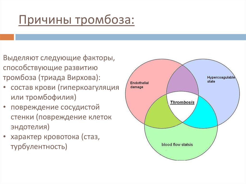 Причины тромбоза