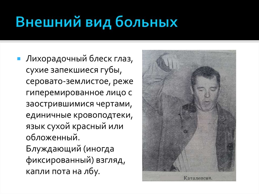 Гебефрения. Вид больного шизофренией. Внешний вид больного типа. Внешний вид человека с шизофренией.