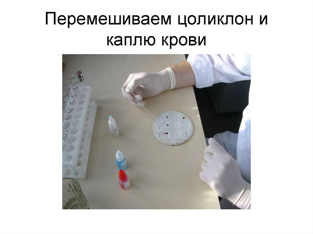 Перемешиваем цоликлон и каплю крови