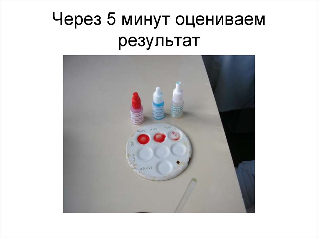 Через 5 минут оцениваем результат