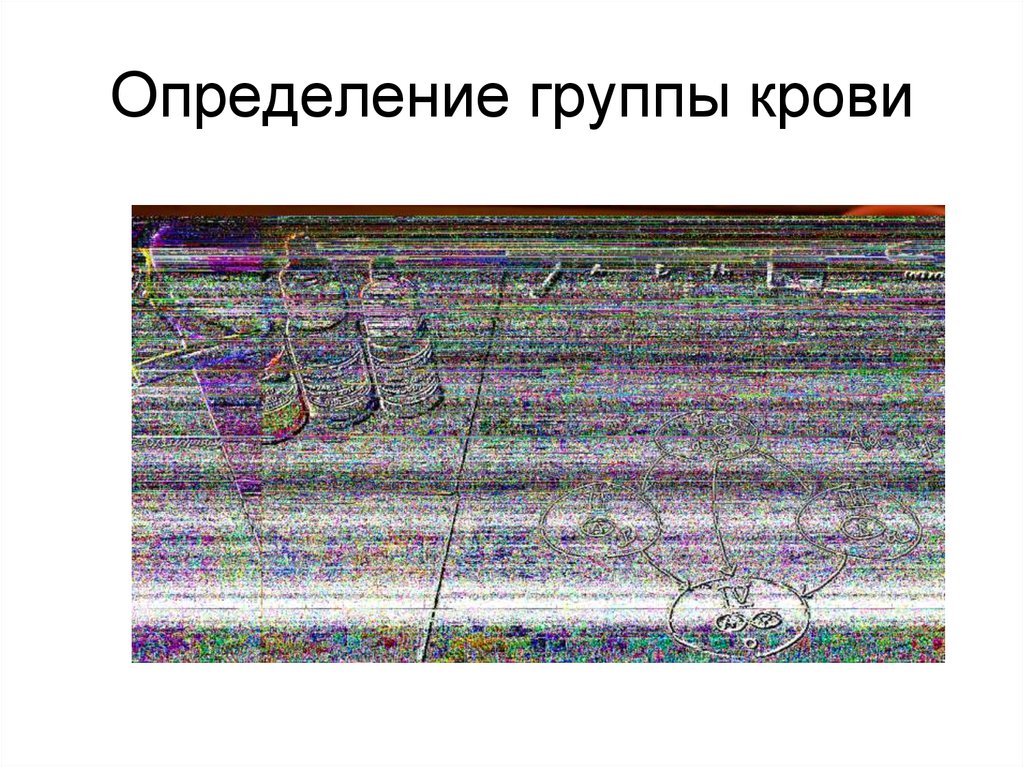 Определение группы крови