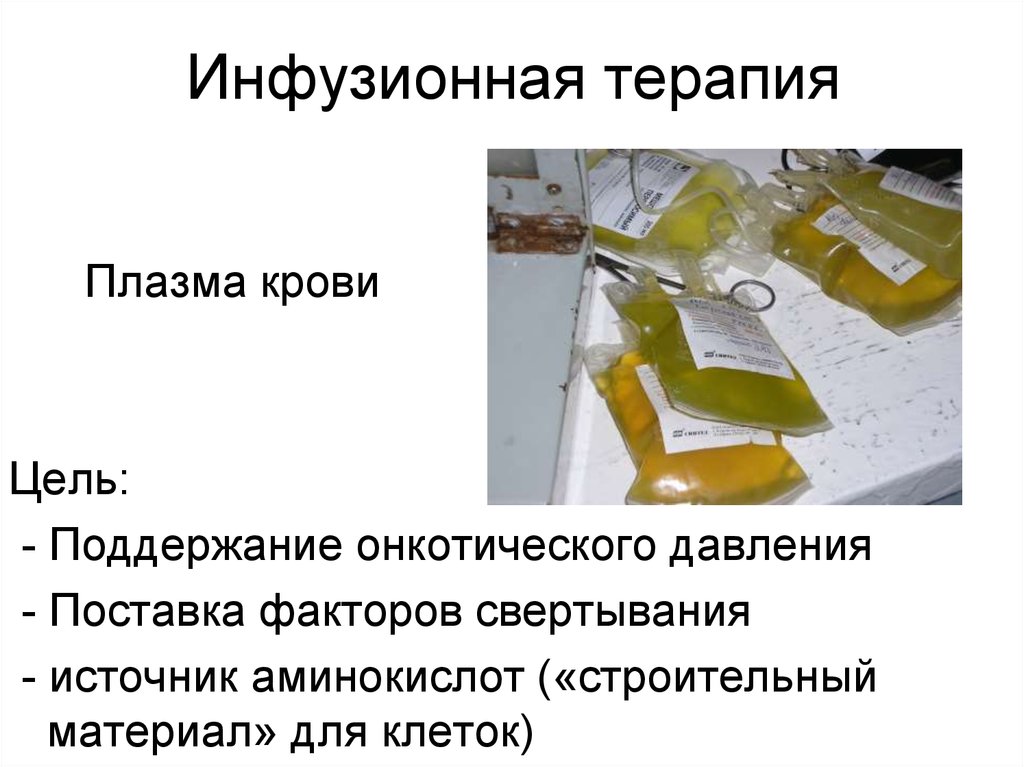 Инфузионная терапия