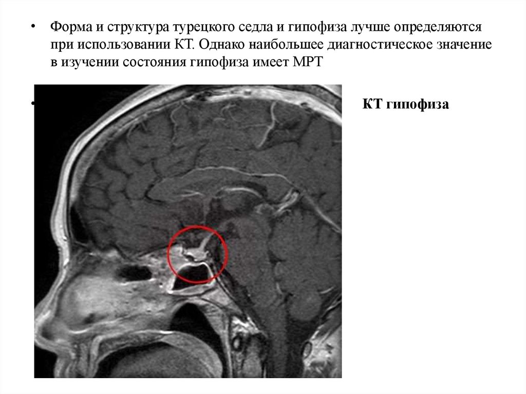 Пустое турецкое седло