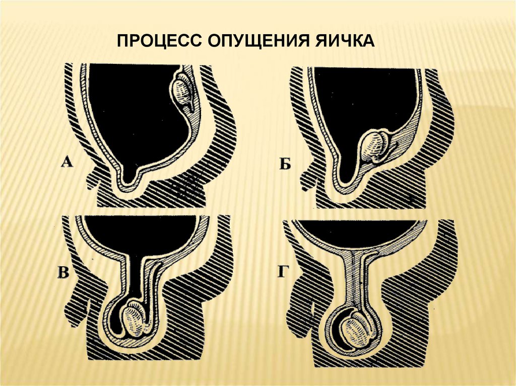 Грыжи живота госпитальная хирургия презентация