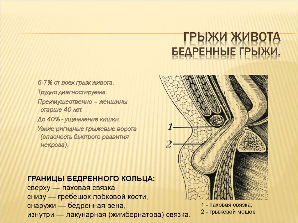 Бедренные грыжи топографическая анатомия презентация