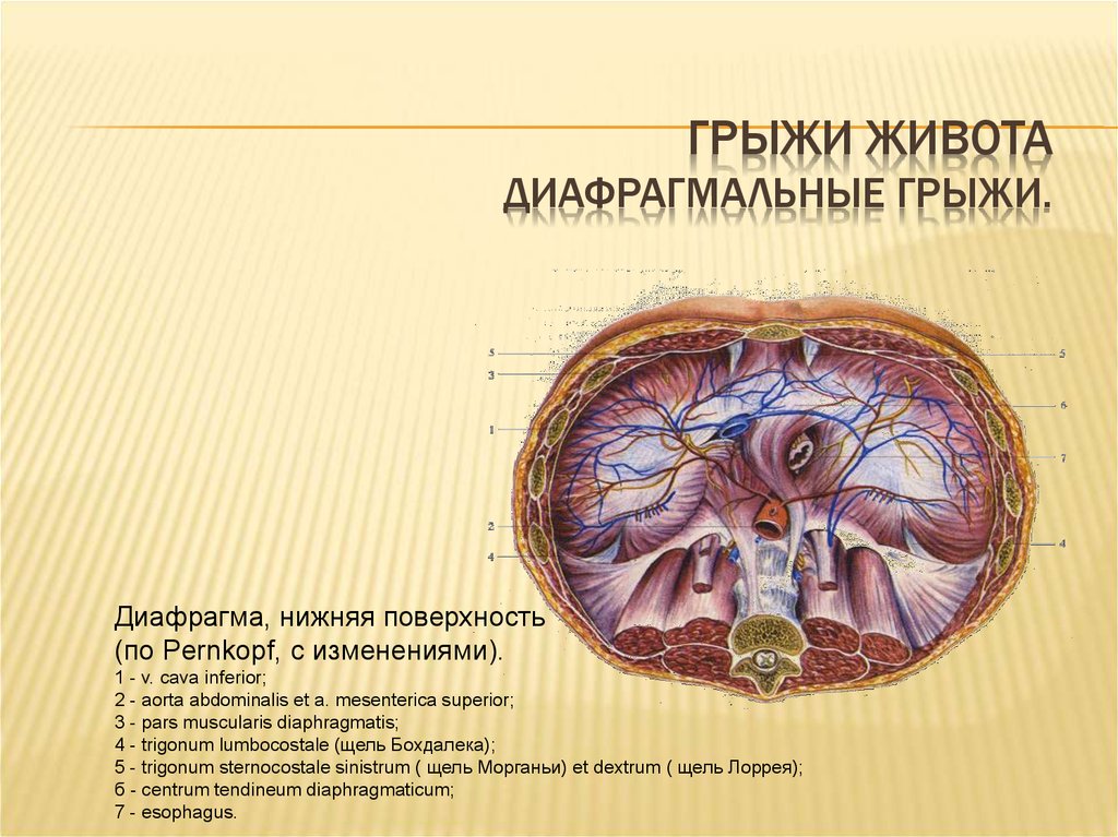 Грыжа бохдалека. Задняя диафрагмальная грыжа Бохдалека. Грыжи диафрагмы Ларрея. Грыжи диафрагмы Бохдалека. Грыжи диафрагмы Морганьи.