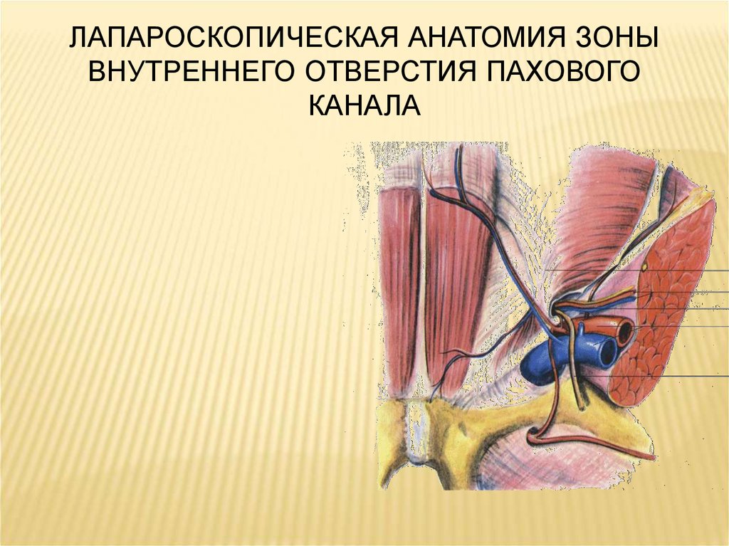 Живот синоним. Лапароскопическая герниопластика анатомия. Лапароскопическая анатомия пахового канала. Отверстия пахового канала. Лапароскопические методы укрепления отверстия пахового канала.