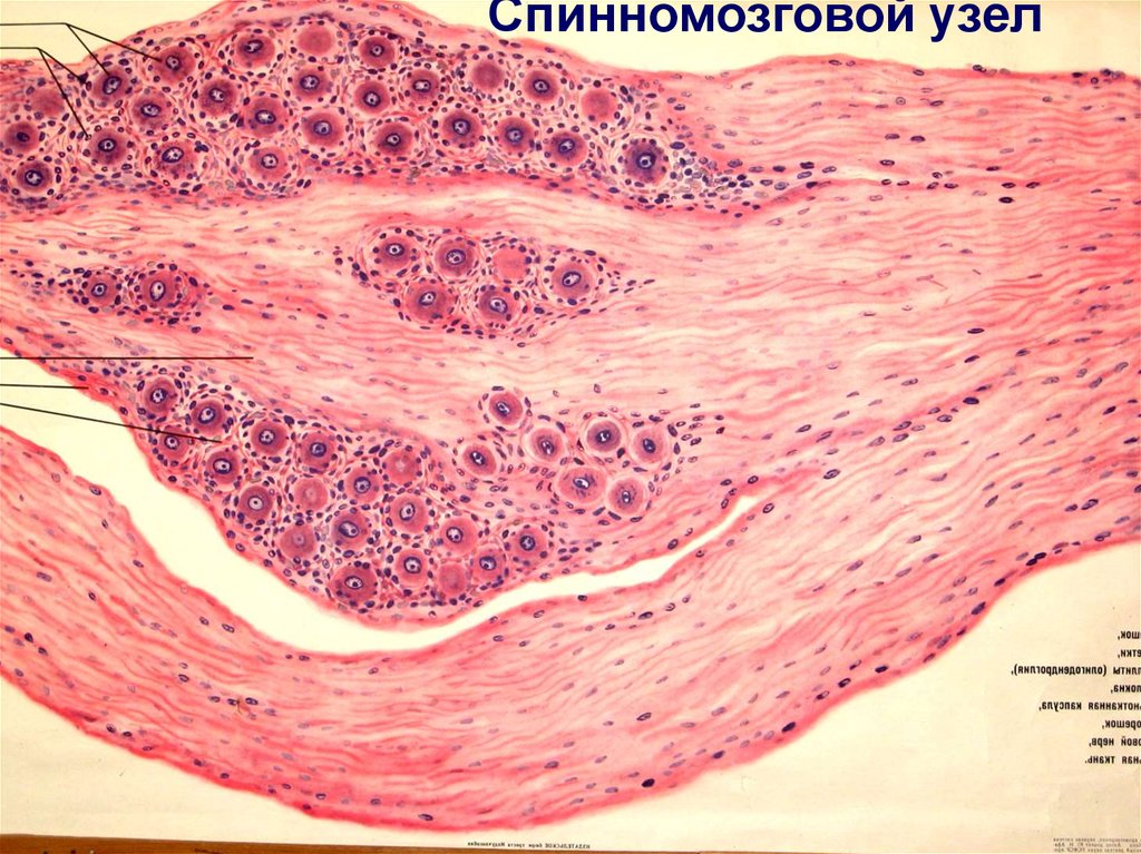 Спинной нервный ганглий