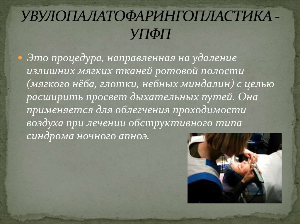 Мкб апноэ сна. Увулопалатофарингопластика. Операция увулопалатофарингопластика. Схема увулопалатофарингопластика. Увулопалатофарингопластика ход операции.