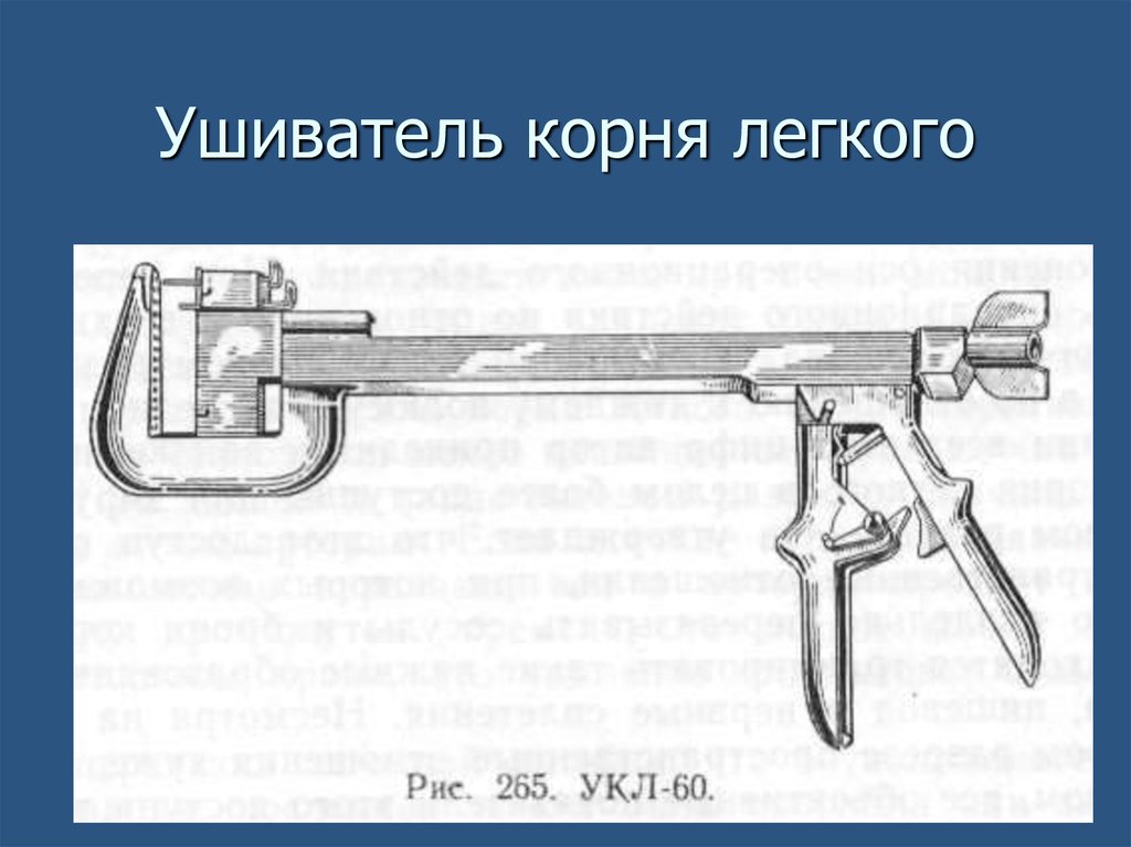Ушиватель корня легкого