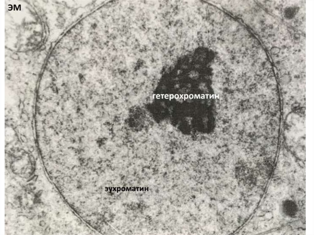 Эухроматин и гетерохроматин это. Эухроматин и гетерохроматин. Хроматин эухроматин и гетерохроматин. Организация хроматина: эухроматин и гетерохроматин..