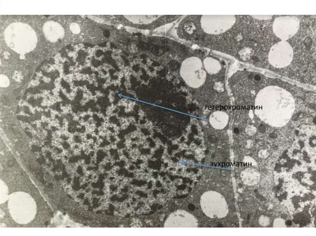 Эухроматин и гетерохроматин это. Ядрышко это гетерохроматин. Эухроматин и гетерохроматин. Хроматин эухроматин и гетерохроматин. Интерфазный хроматин эухроматин и гетерохроматин.