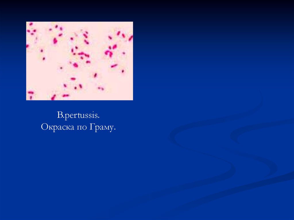 Окраска по граму. Коклюш окраска по Граму. Bordetella pertussis окраска по Граму. B pertussis по Граму. Бордетелла пертуссис мазок.