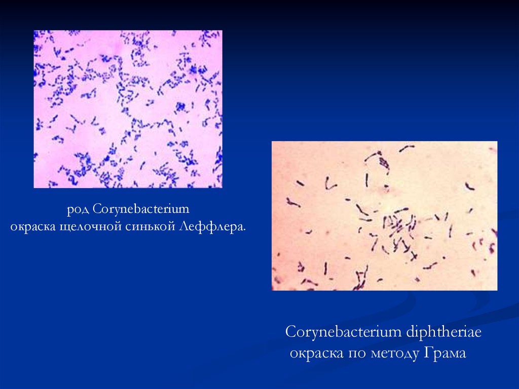 Возбудители дифтерии являются. Коринобактерия Леффлера. Corynebacterium diphtheriae окраска по Граму. Corynebacterium diphtheriae окраска по Нейссеру. Коринебактерии дифтерии по Граму.