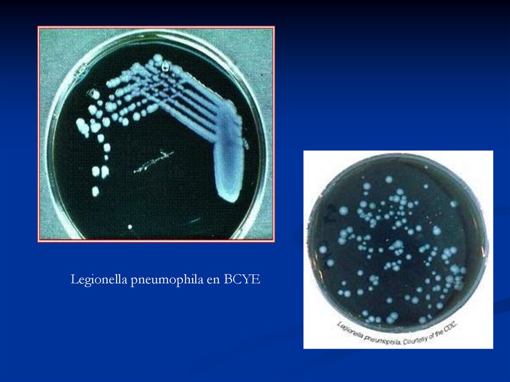 Legionella pneumophila. Легионелла пневмофилия. Легионеллы среда. Питательные среды для легионелл. Легионеллез на среде.