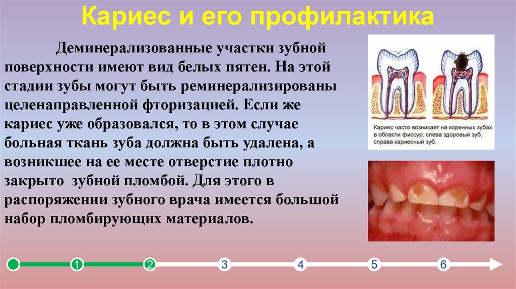 Профилактика кариеса презентация