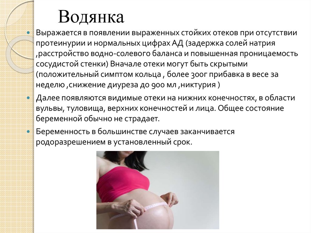 Почему происходит ранняя беременность. Водянка на животе у беременных. Водянка беременных клиника. Водянка беременных гестоз.