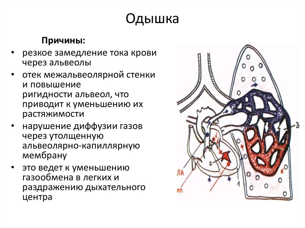 Одышка легких. Легочная одышка. Одышка причины. Замедление тока крови причины. Смешанная одышка.