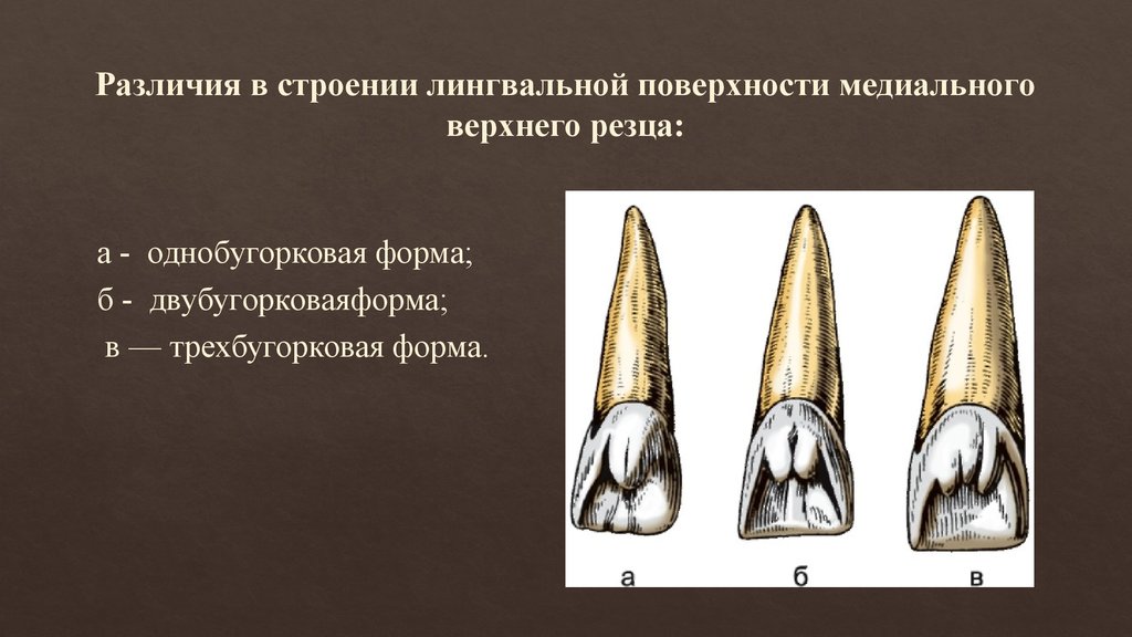 Резцы верхней челюсти